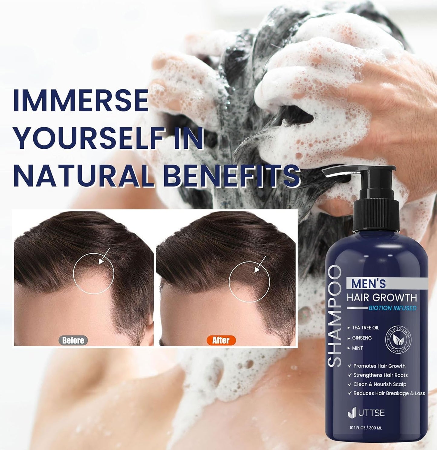 Uttse Biotion Hair Growth Shampoo - Natural Thickening Formula with Tea Tree Oil & Ginseng | 10.1 fl. oz, Dark Blue