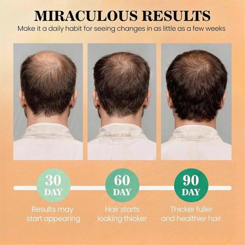 Dr Sebi Batana Oil - 100% Raw Organic Hair Growth Mask | Promotes Thickness & Prevents Loss - 2 fl oz