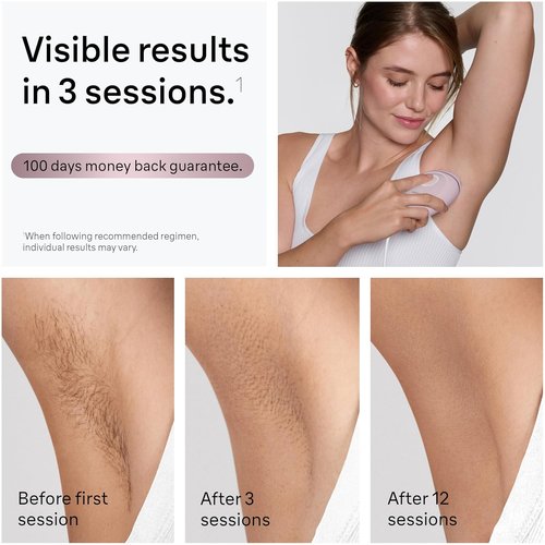 Braun Silk·Expert Mini IPL Hair Removal Device - At-Home Permanent Laser Hair Reduction for All Skin Types