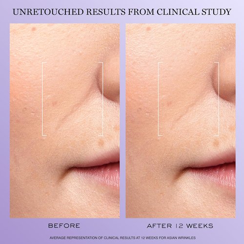 Lancôme Rénergie H.C.F. Triple Serum - Anti-Aging Hyaluronic Acid Serum with Vitamin C+, Niacinamide & Ferulic Acid - 1.0 oz
