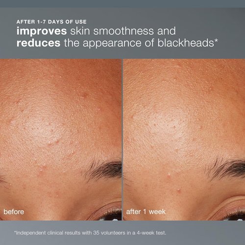 Dermalogica Daily Microfoliant, Face Exfoliator Scrub Powder with Salicylic Acid and Papaya Enzyme, Achieve Brighter, Smoother Skin Daily