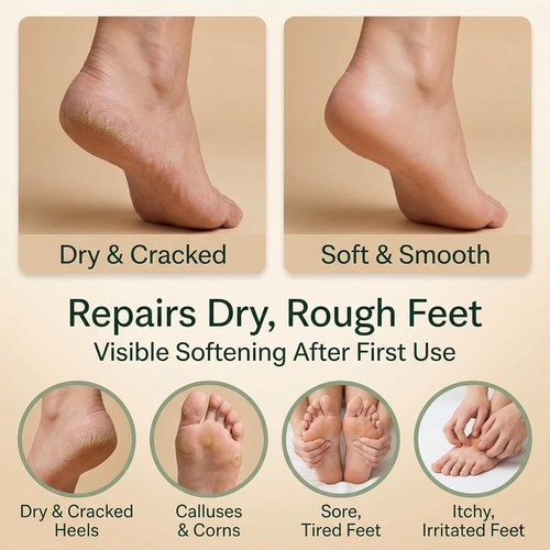 Natural Escapes Peppermint Foot Cream - Deep Moisturizing Heel Repair with Tea Tree & Eucalyptus, 4 oz