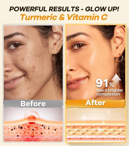 Revitalizing Exfoliation Face Scrub by [Brand Name] - Vitamin C & Turmeric for Acne Control | 4.23 Fl Oz