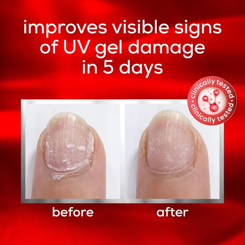 Essie Nail Care - UV Gel Damage Repair Treatment | To The Rescue Base Coat, 0.46 Fl Oz