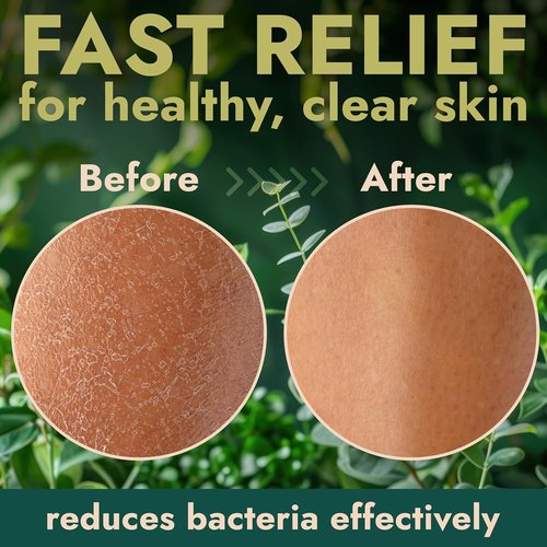 Antibacterial Body Wash by Manuka Honey | Kills 99.9% of Germs & Bacteria | 16 fl oz for Clear Skin