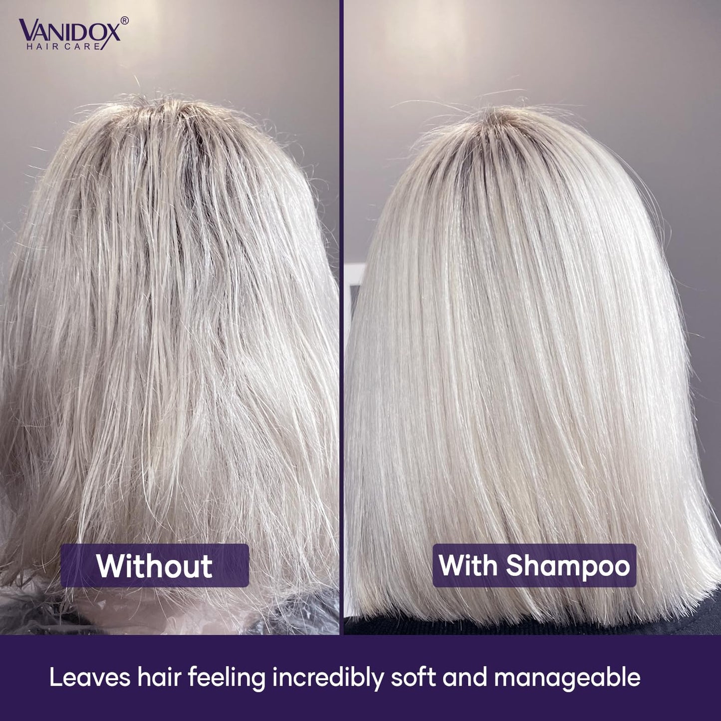VANIDOX Purple Shampoo & Conditioner Set - Sulfate-Free, Moisturizing for Grey & Silver Hair | 16 fl oz Each