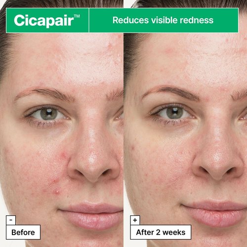 Dr.Jart+ Cicapair Soothing Gel Cream - Visibly Irritated Skin Relief with Centella Asiatica | 1.01 Fl Oz