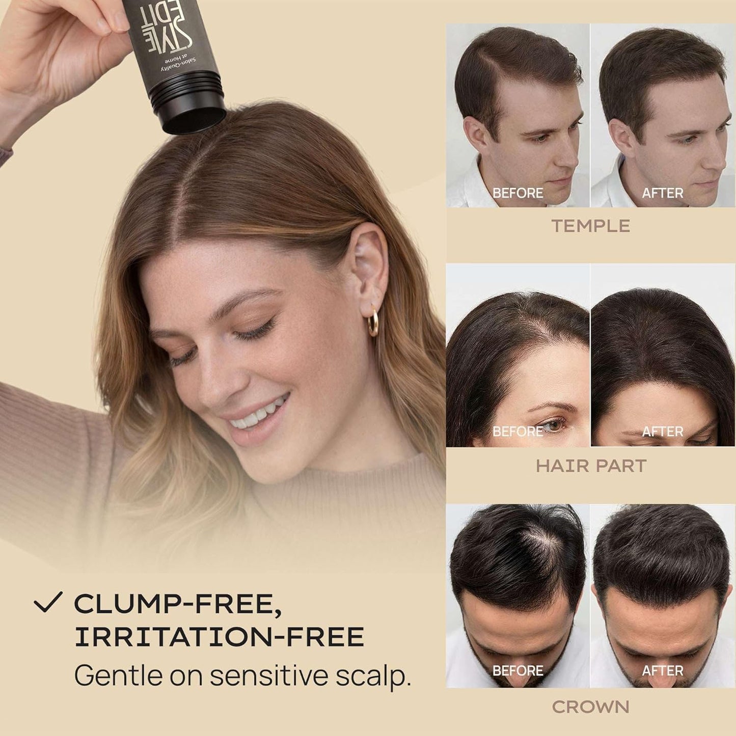 Style Edit Hair Building Fibers - Conceal Thinning Hair & Bald Spots | 100% Plant-Based, Medium Brown 0.88oz
