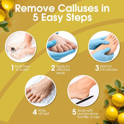 DeEnti Callus Remover Gel - Extra Strength 8oz for Dry Skin & Cracked Heels | Professional Pedicure Care