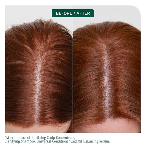 Biolage Scalp Sync Clarifying Shampoo - Effective Residue & Buildup Remover for Oily Scalp