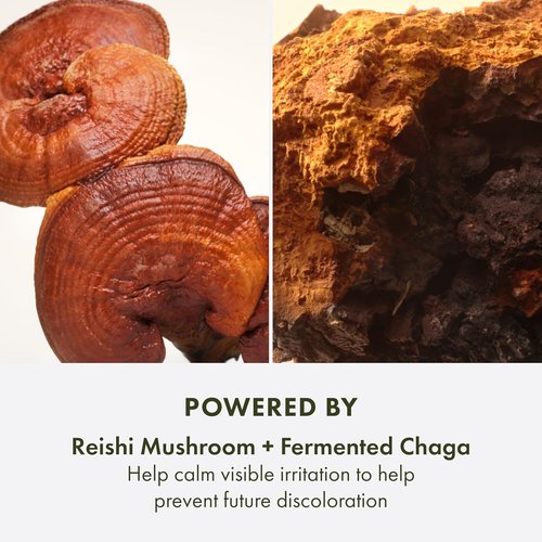 Origins Mega-Mushroom Dark Spot Serum - Reduce Hyperpigmentation & Post-Acne Marks | Vitamin C & Reishi Mushroom, 1 Fl Oz