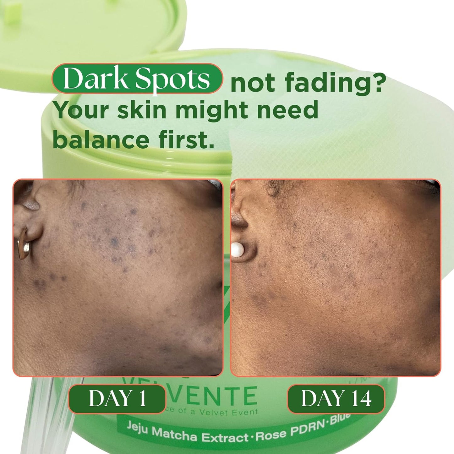 Skiennix Matcha Facial Moisturizer - Hydrating & Firming Cream with Rose PDRN for All Skin Types | 3.53 oz