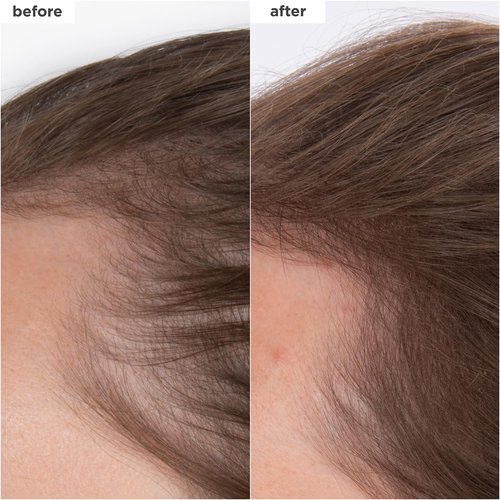 Briogeo Destined For Density Serum - Caffeine & Biotin Peptide for Thicker, Voluminous Hair | Fast-Absorbing, Non-Greasy, Vegan