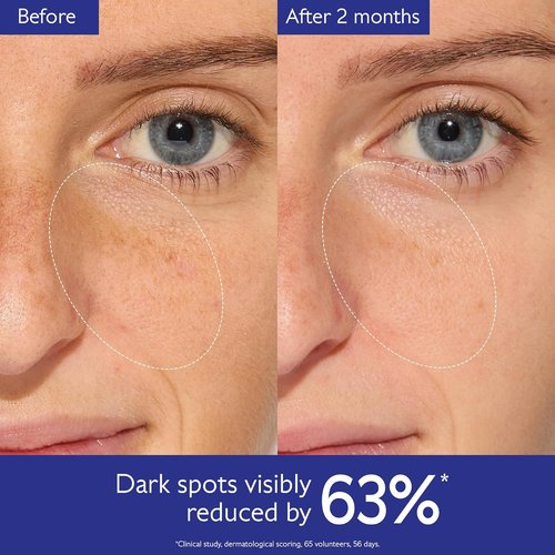 Caudalie Vinoperfect Brightening Dark Spot Serum - 62x More Effective Than Vitamin C for Radiant Skin
