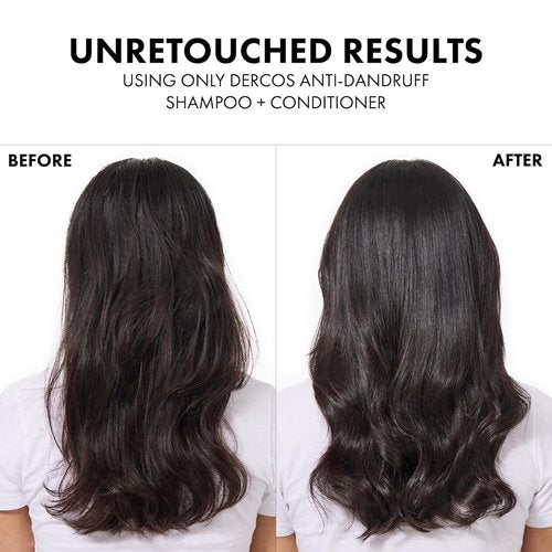 Dercos Hair & Scalp Moisturizing Conditioner - Strengthens & Hydrates with Glycerin, Niacinamide + Hyaluronic Acid | 6.7 Fl Oz