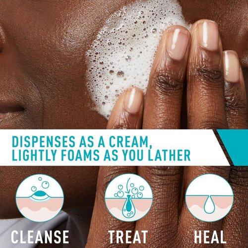 CeraVe Acne Foaming Cream Cleanser - 4% Benzoyl Peroxide Face Wash with Hyaluronic Acid & Niacinamide