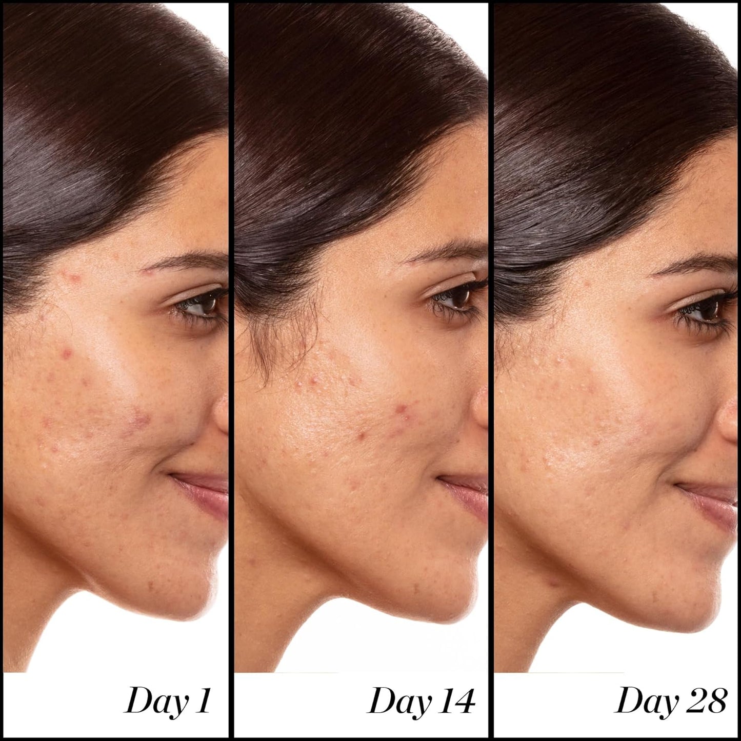 Sunday Riley A+ High-Dose Retinol Serum - Powerful Anti-Aging Treatment for Youthful Skin