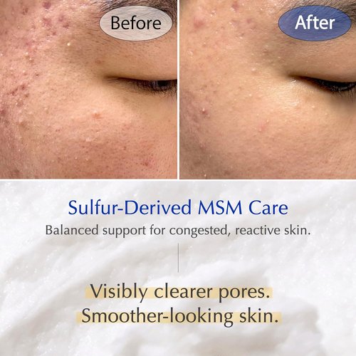 MSM Sulfur Deep Pore Cleanser - Gentle Low pH Face Wash for Sensitive Skin, Pore Reset Formula
