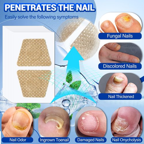Regine Switzerland Toenail Fungus Treatment - 50 Extra Strength Hydrogel Nail Patches for Overnight Repair