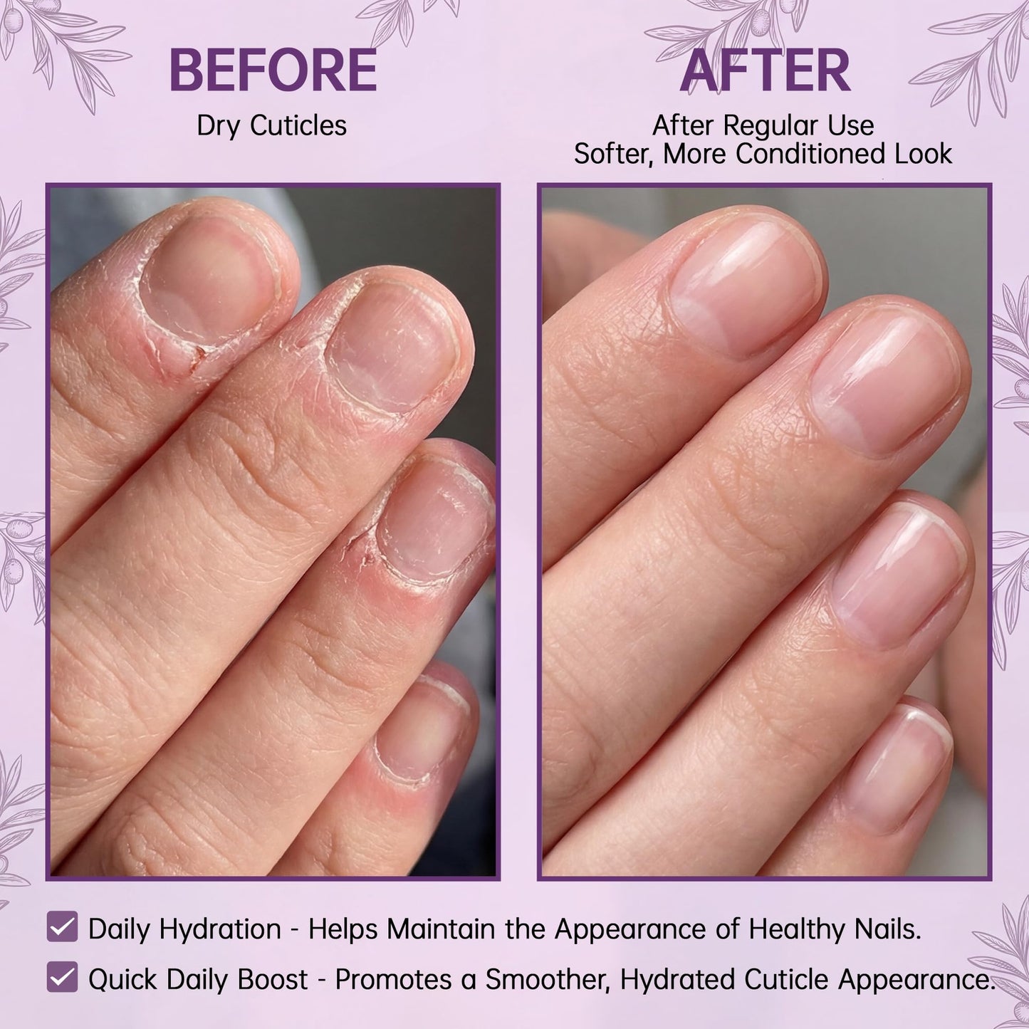 WM WONDER MOJO Cuticle Oil Pen for Dry Cracked Cuticles, Hydrating Nail Moisturizer with Jojoba Oil, Vitamin E, Tea Tree & Squalane, Portable Brush Pen