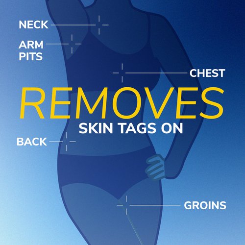 Dr. Scholl's Freeze Away Skin Tag Remover Kit, 8 ct – Completely removes Skin Tags in As Little As 1 Treatment, FDA-Cleared & Clinically Proven At-Home Removal, Easy 1-Handed Action, Permanent Results