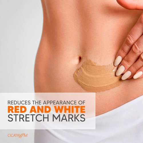 Cicatrissim Stretch Mark Cream - Softens & Firms Skin, Evens Tone - All Skin Types - 150g