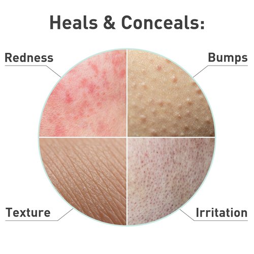 PROcure Rosacare Redness Relief Face Mask - 5 Pack | Hydrating Hyaluronic Acid & Calming Licorice Root for Sensitive Skin