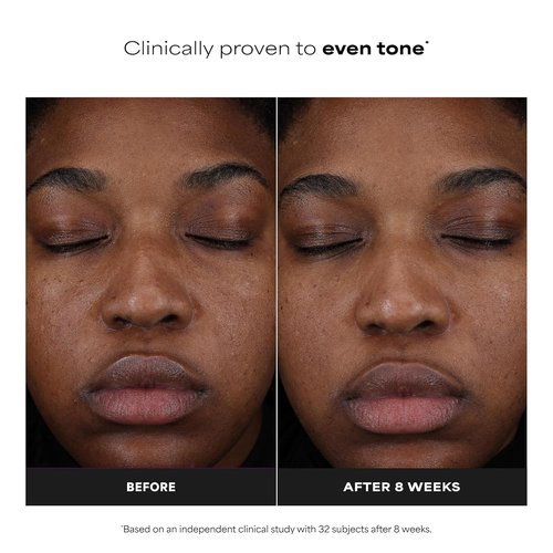 Paula’s Choice 25% Vitamin C Serum - Brightening Face Serum with Glutathione & Antioxidants | 1oz, Fragrance-Free