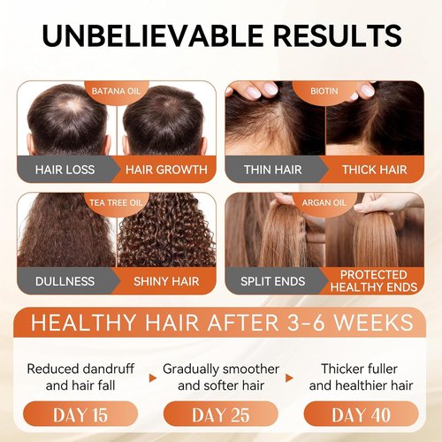 Regine Switzerland Castor Oil Shampoo & Conditioner Set - Strengthen & Restore Thin Hair | Sulfate-Free, 16.9 FL Oz