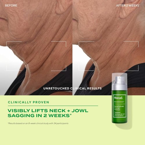 Murad Retinal ReSculpt Overnight Treatment - Advanced Face and Neck Serum with Encapsulated Retinal, Kangaroo Paw, Olive, & Oat Smooths Deep Wrinkles and Crepey Skin, & Lifts Sagging Skin