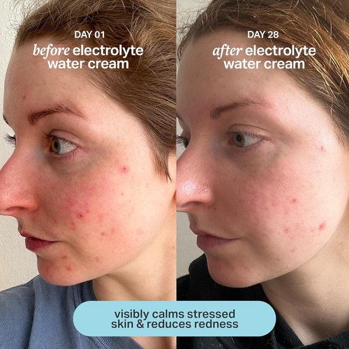 Cocokind Electrolyte Water Cream - Lightweight Hydrating Gel Moisturizer for All Skin Types | 1.7 Fl Oz