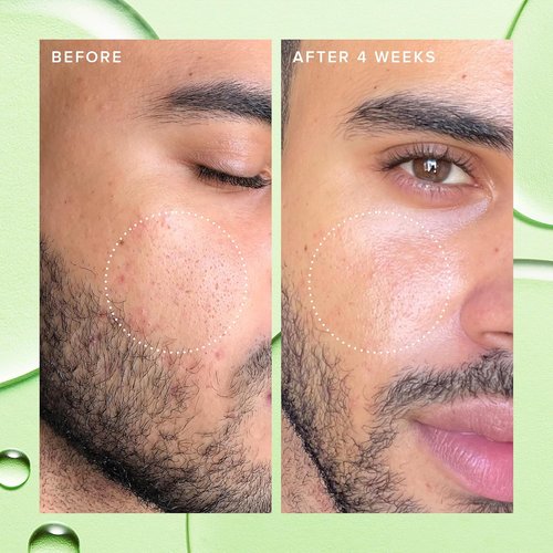 Farmacy 2% Salicylic Acid Toner - Deep Sweep BHA Exfoliant & Pore Cleaner for Oily Skin | 120ml