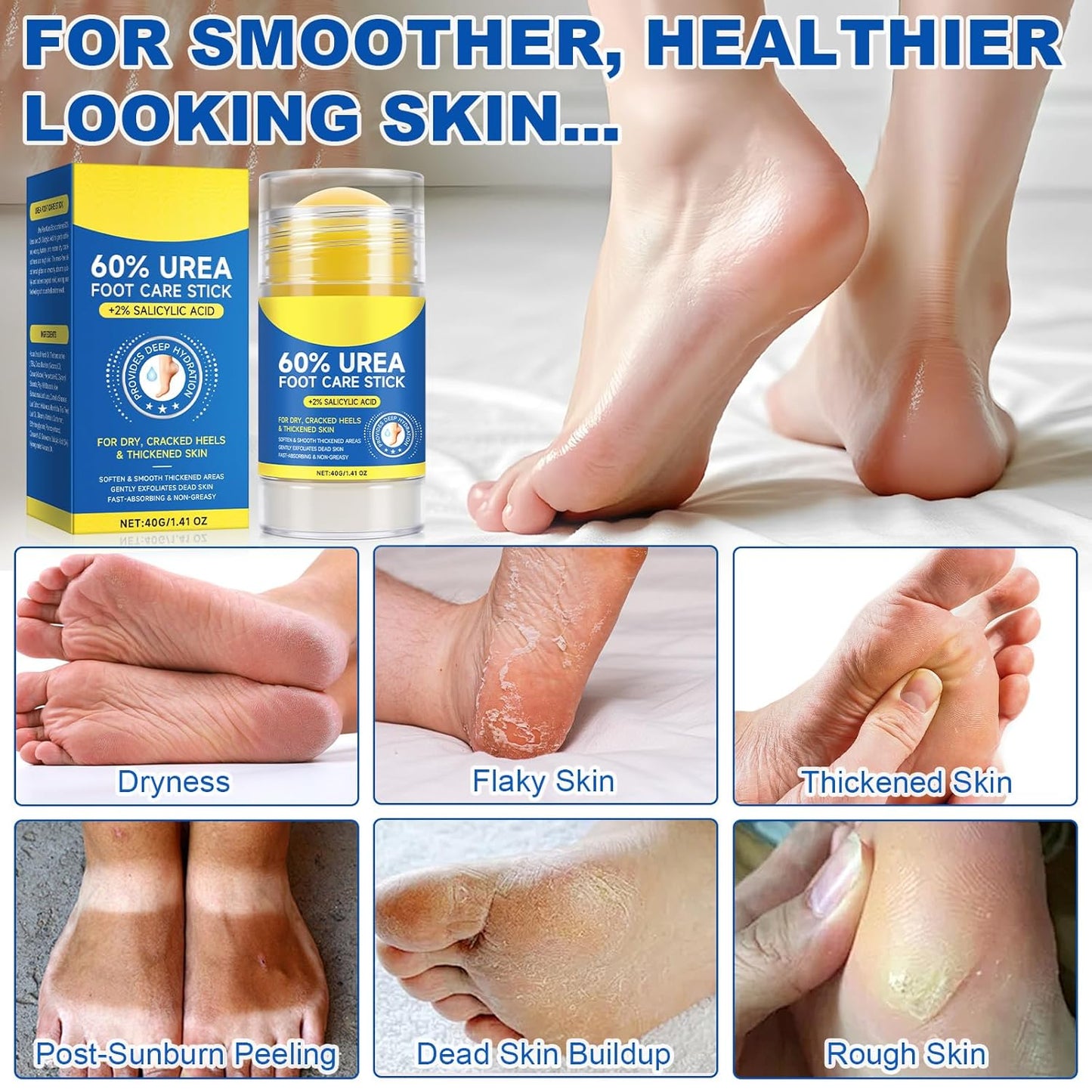 Skiennix 60% Urea Cream Stick - Maximum Strength Foot Cream with 2% Salicylic Acid | Softens Dry Cracked Heels