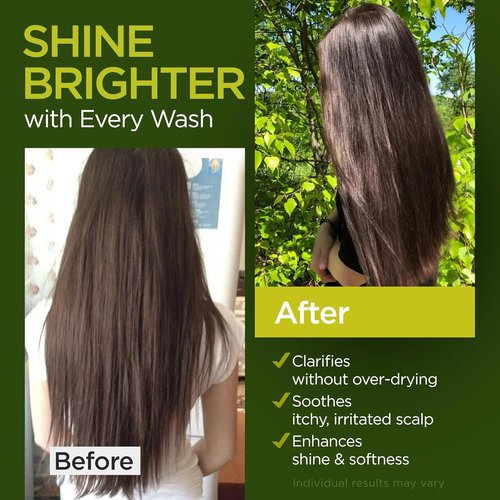 Regine Switzerland Tea Tree Rosemary Shampoo & Conditioner Set - Nourishing Cleanse & Scalp Support for All Hair Types | Paraben & Sulfate Free (16 Oz Each)