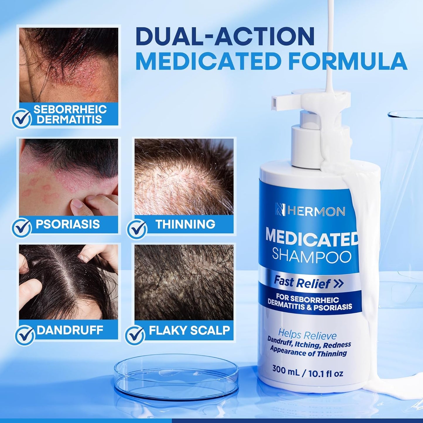 Skiennix Medicated Shampoo - Plant-Based Formula for Scalp Dermatitis & Psoriasis | 300ml/10.0fl oz