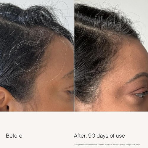 Living Proof Scalp Care Density Serum - Boost Hair Thickness & Volume | 2 oz