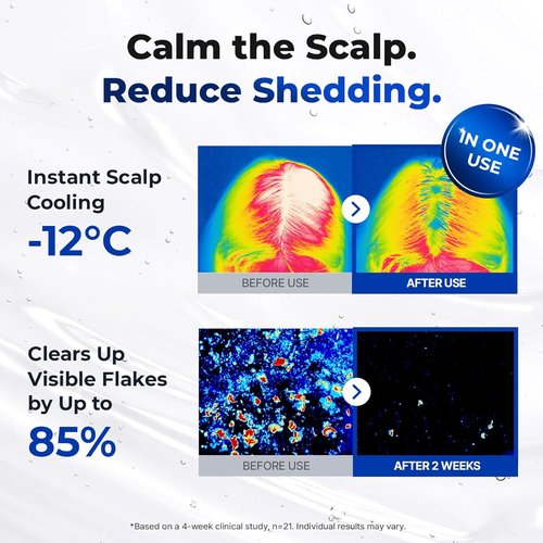 EPAIS Scalp Boosting Serum - 150ml Comb Applicator with 38 Brush Tips for Dandruff Reduction | Korean Hair Care