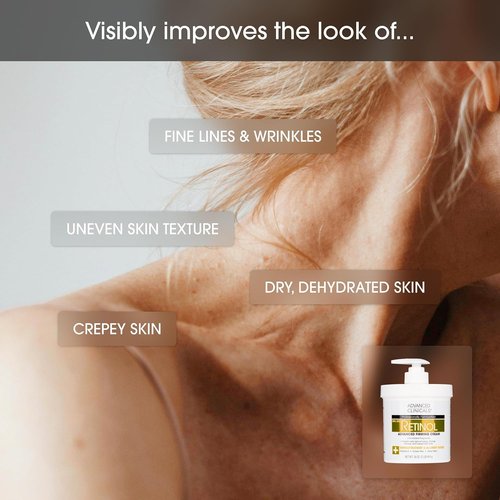 Advanced Clinicals Retinol Body Lotion - Anti-Aging Moisturizer for Face & Body | 16 Ounce, Targets Fine Lines & Wrinkles