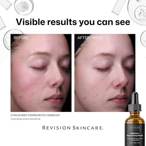 Revison Skincare Radiance+ Resurfacing Serum - Overnight AHA+BHA Exfoliant with Glycolic & Salicylic Acid | Smooths Texture & Brightens Skin