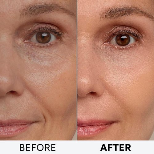 Regine Switzerland Retinol Cream - Anti-Aging Facial Moisturizer with Collagen & Hyaluronic Acid | Day & Night Use for Firm, Youthful Skin