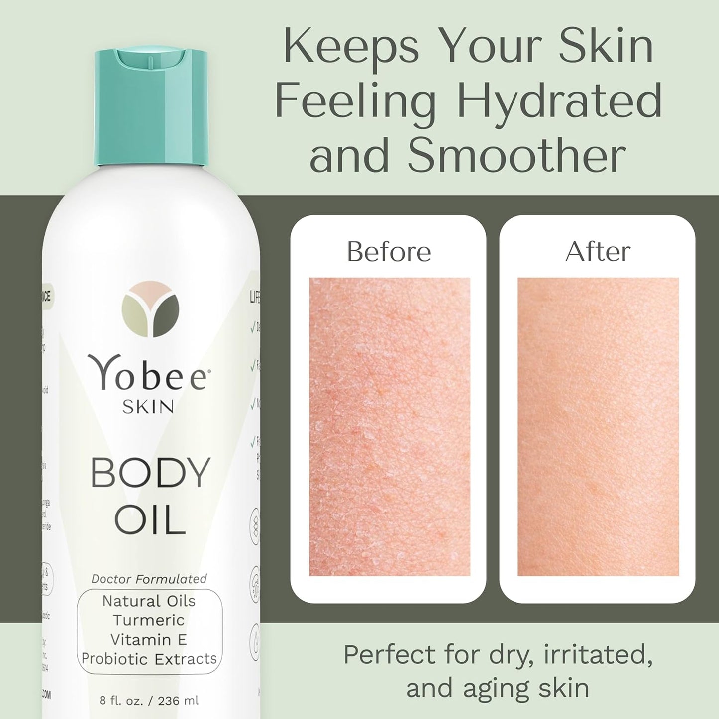 Yobee Probiotic Body Oil - Deeply Moisturizing for Dry, Itchy Skin | Natural Five-Oil Blend with Turmeric, 8oz