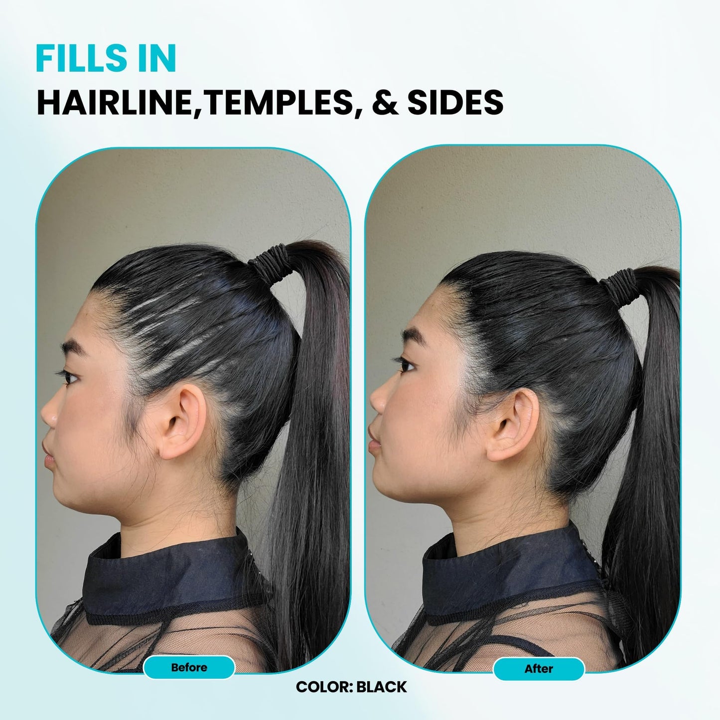 SURETHIK Hair Fibers, 30g (Auburn), Fills Thinning Hair for Visibly Fuller Look, Conceals Bald Spots, Natural Look, For Men & Women