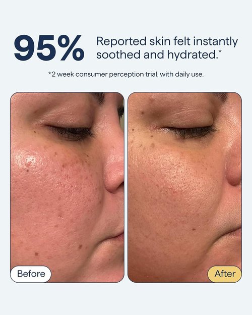Dr. Shah Remedy Gel Moisturizer - Lightweight Hydrating Water Cream for Normal to Oily Skin | 1.7 fl. oz