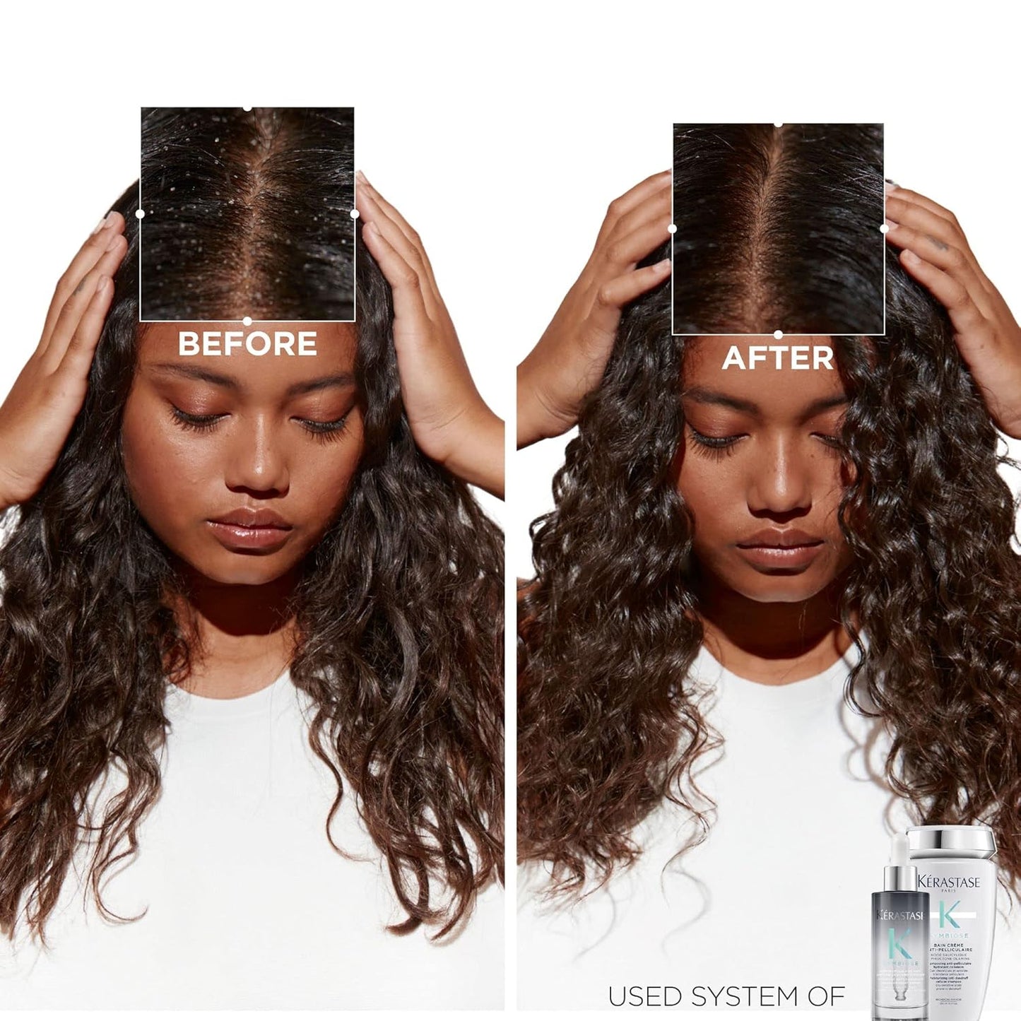 Kerastase Symbiose Antidandruff Serum - Soothes & Hydrates Dandruff-Prone Scalp | 3.04 Fl Oz