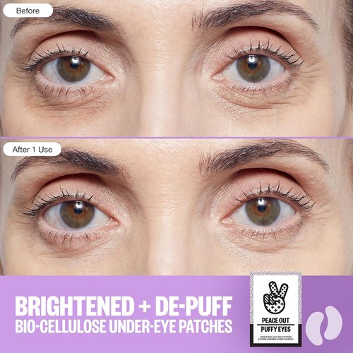 Peace Out Puffy Eyes Under Eye Patches - Biocellulose Mask with Caffeine & Niacinamide (6 Pairs)