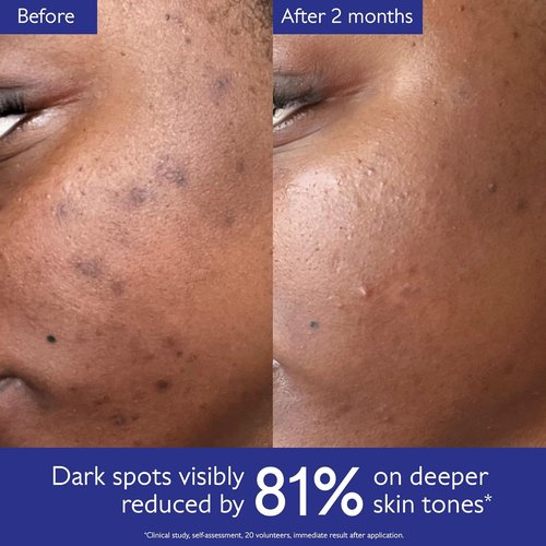 Caudalie Vinoperfect Brightening Dark Spot Serum - 62x More Effective Than Vitamin C for Radiant Skin
