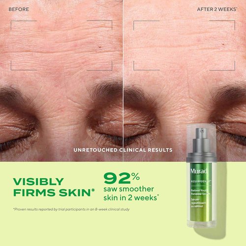 Murad Rejuvenate + Replenish Set - 3-Piece Full-Sized Skin Care Regimen for Total Health | Cleanser, Serum, Moisture