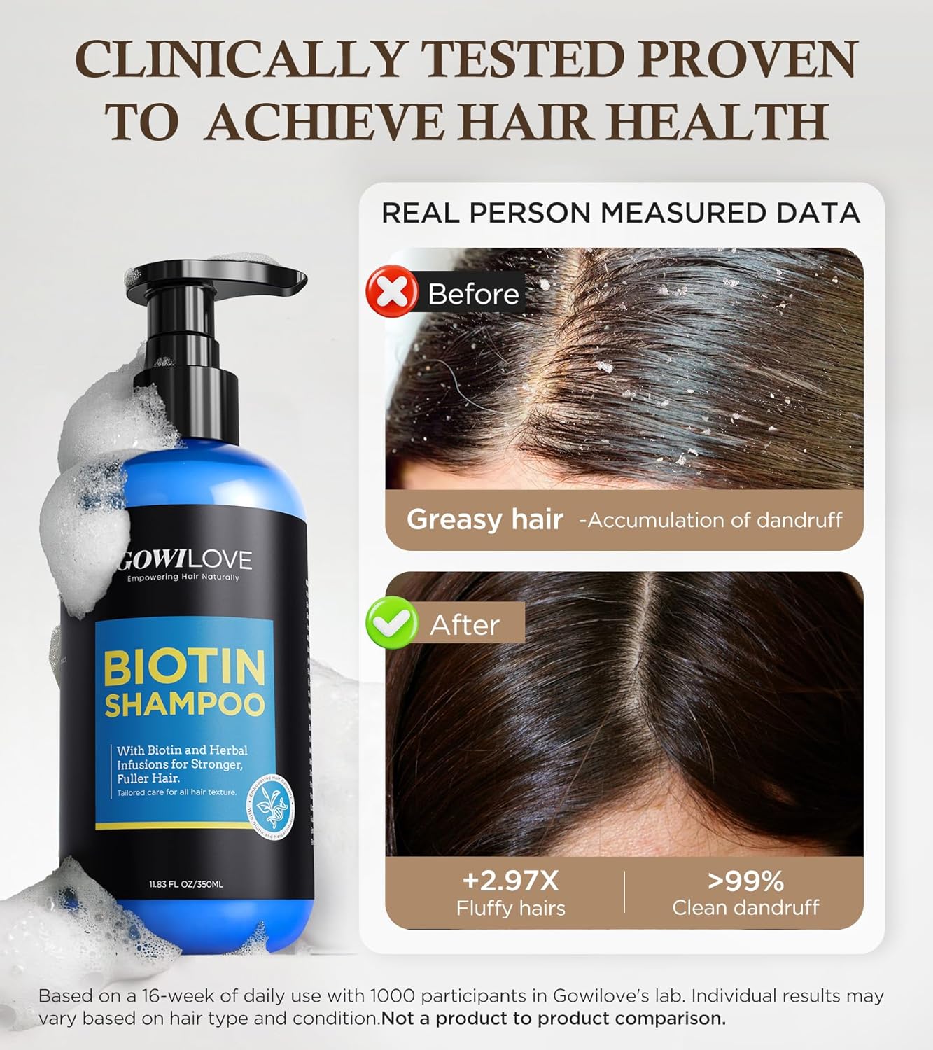 Skiennix 99% Pure Biotin Shampoo - 3X Thicker Hair Growth & 80% Less Hair Loss | 11.83oz Nourishing Formula