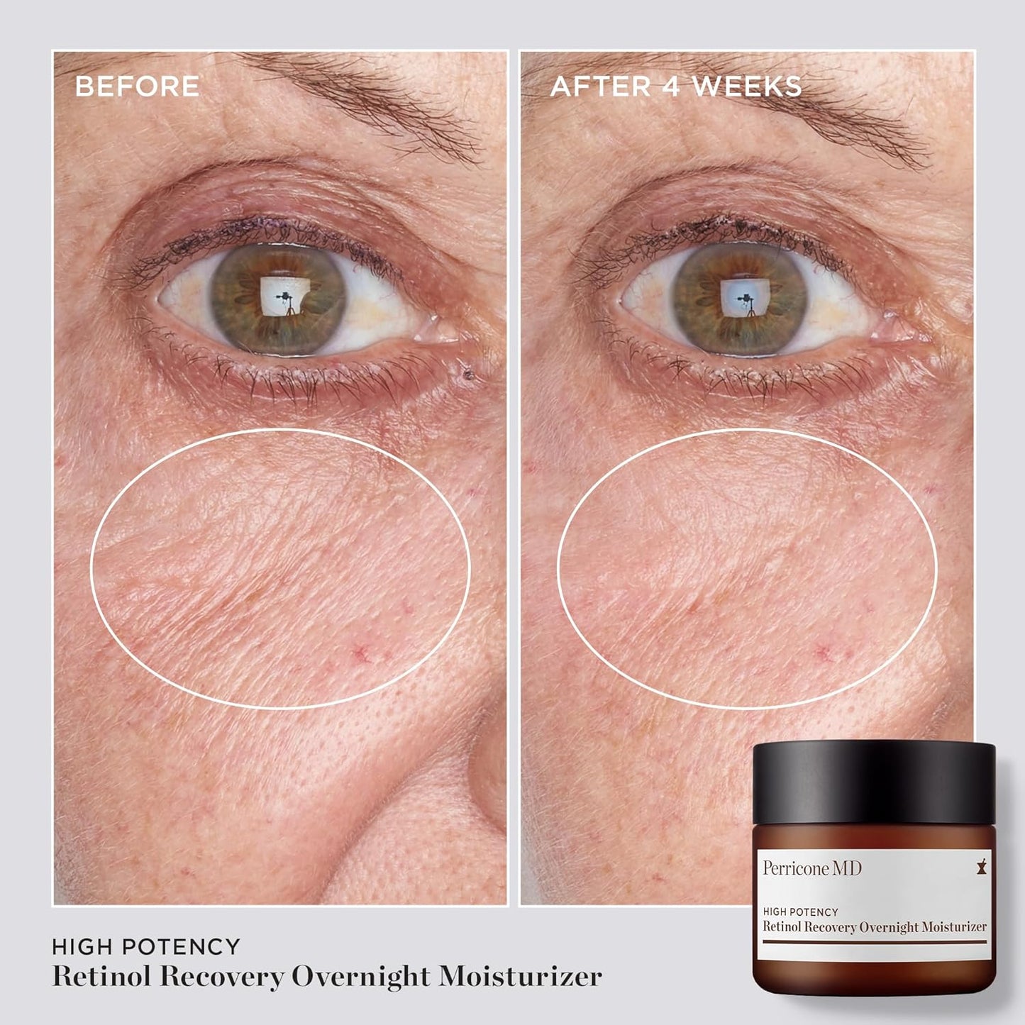 High Potency Classics Retinol Recovery Moisturizer - Overnight Anti-Aging Formula