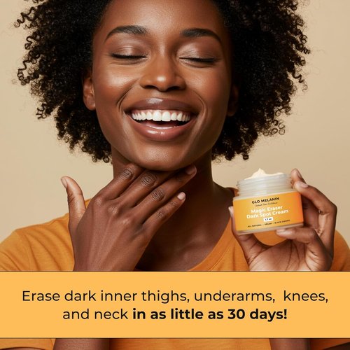 Glo Melanin Magic Eraser Dark Spot Cream - Fade Dark Spots on Face & Body, 1.7 Oz